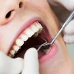 Tips for Choosing the Right Aesthetic Dentist