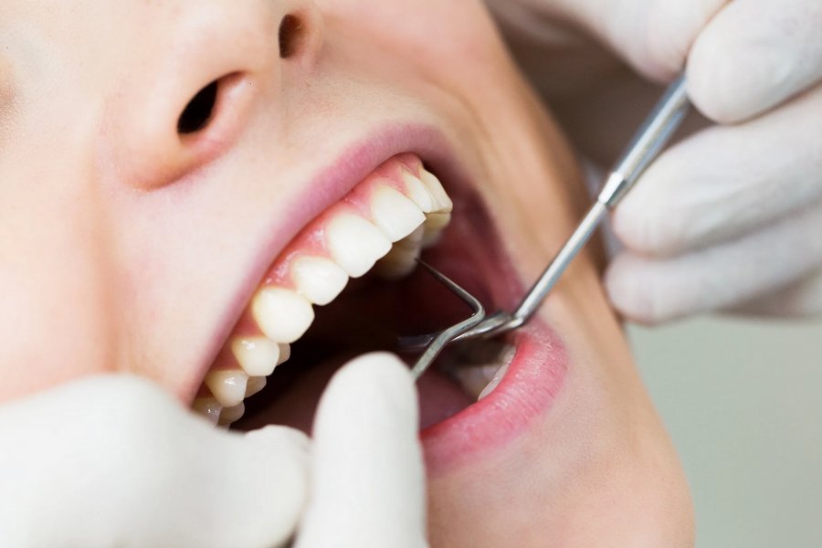 Tips for Choosing the Right Aesthetic Dentist